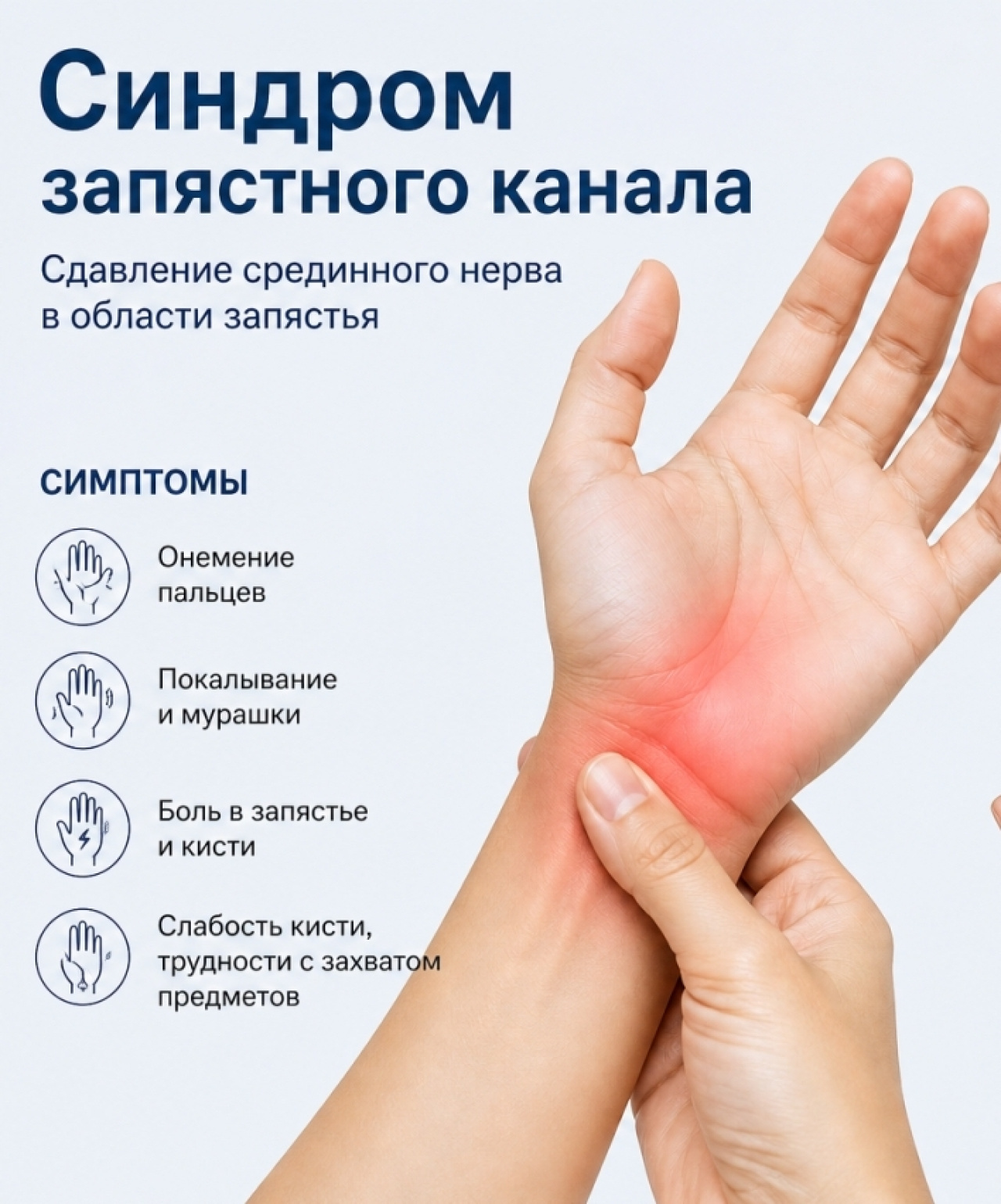 Синдром запястного канала : симптомы, диагностика и лечение&nbsp;