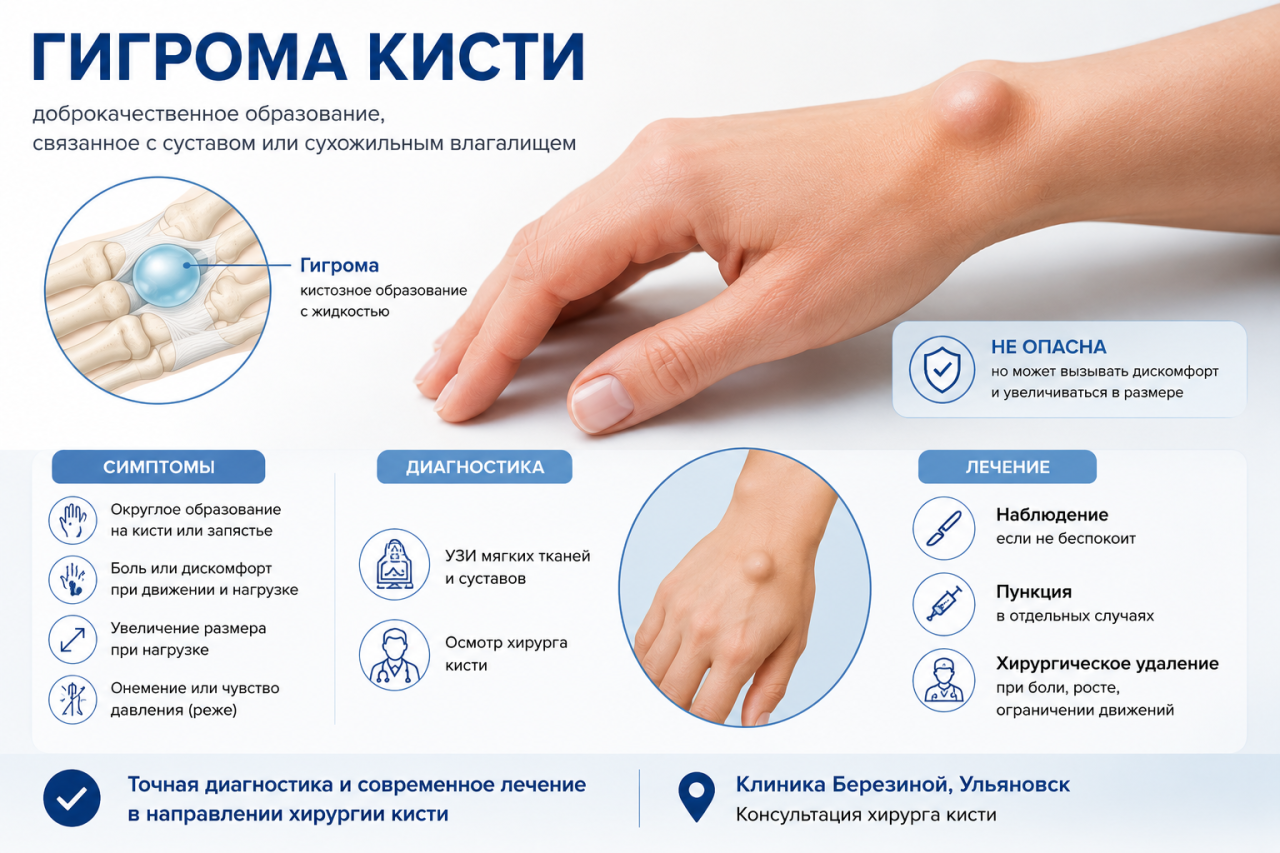 Шишка на запястье, гигрома кисти