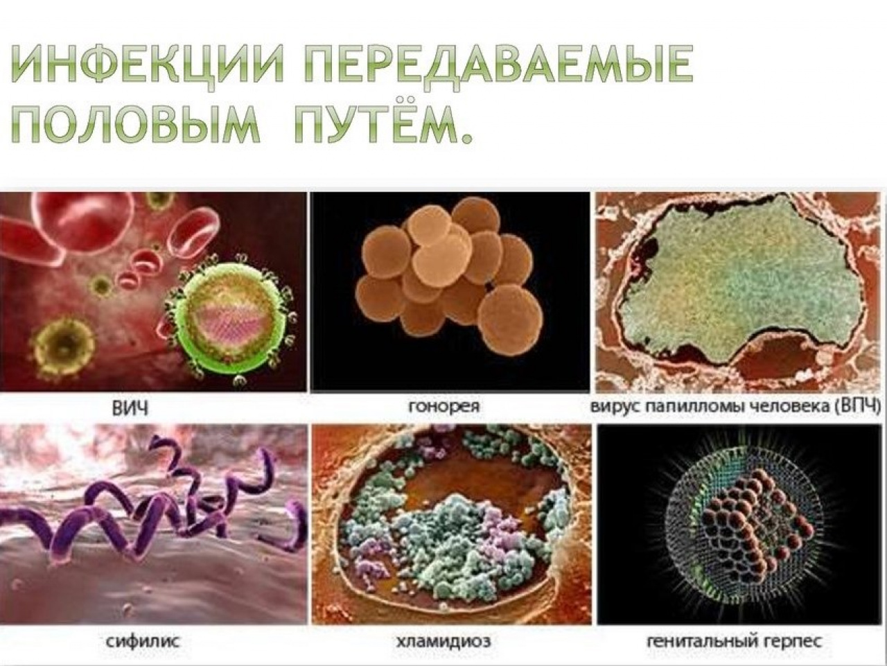 ЗППП ЗППП